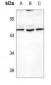 TGF beta 2 Antibody